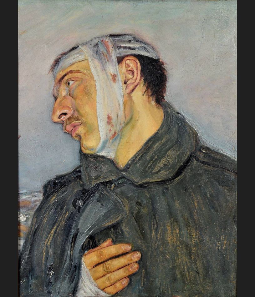 Vlastimil Hofmann " Ranny żołnierz" , olej ok. 1915 roku